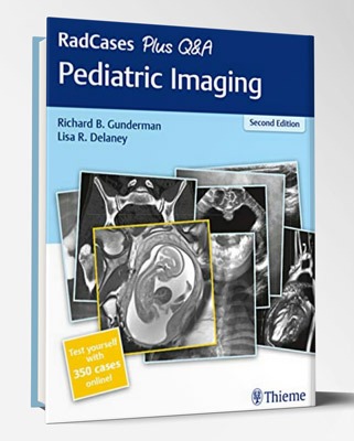 کتاب ۲۰۲۰ Pediatric Imaging – RadCases Plud Q&A – Second Edition