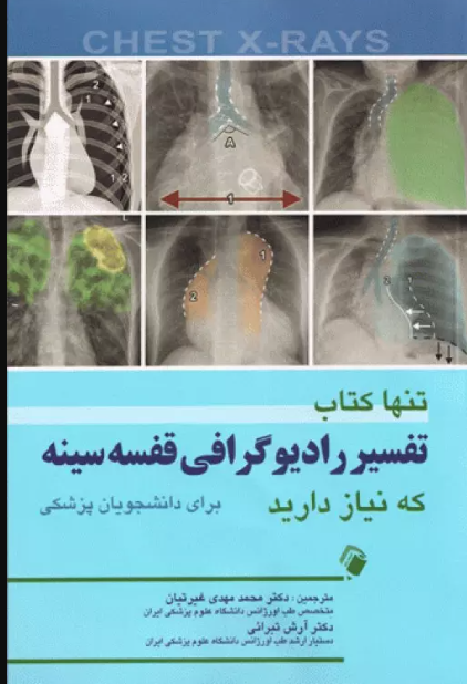 کتاب تنها کتاب تفسیر رادیوگرافی قفسه سینه که نیاز دارید