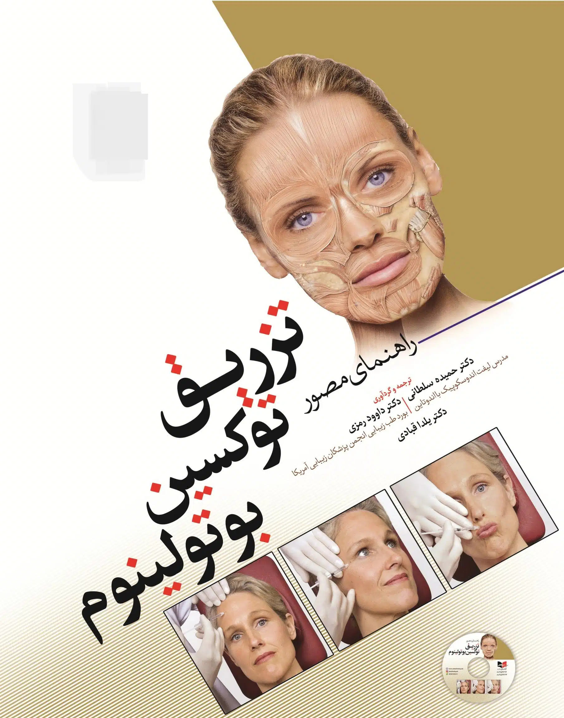 روی-مصور-بوتاکس--scaled کتاب راهنمای مصور تزریق توکسین بوتولینوم | دکتر داوود رمزی