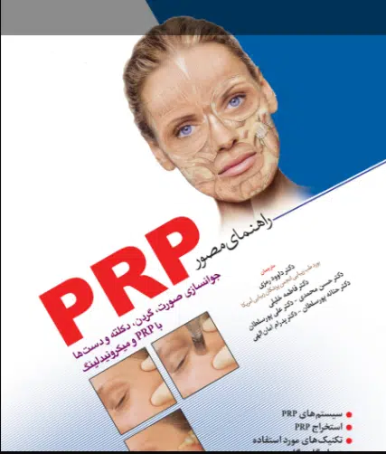 یبل کتاب راهنمای مصور PRP | دکتر داوود رمزی