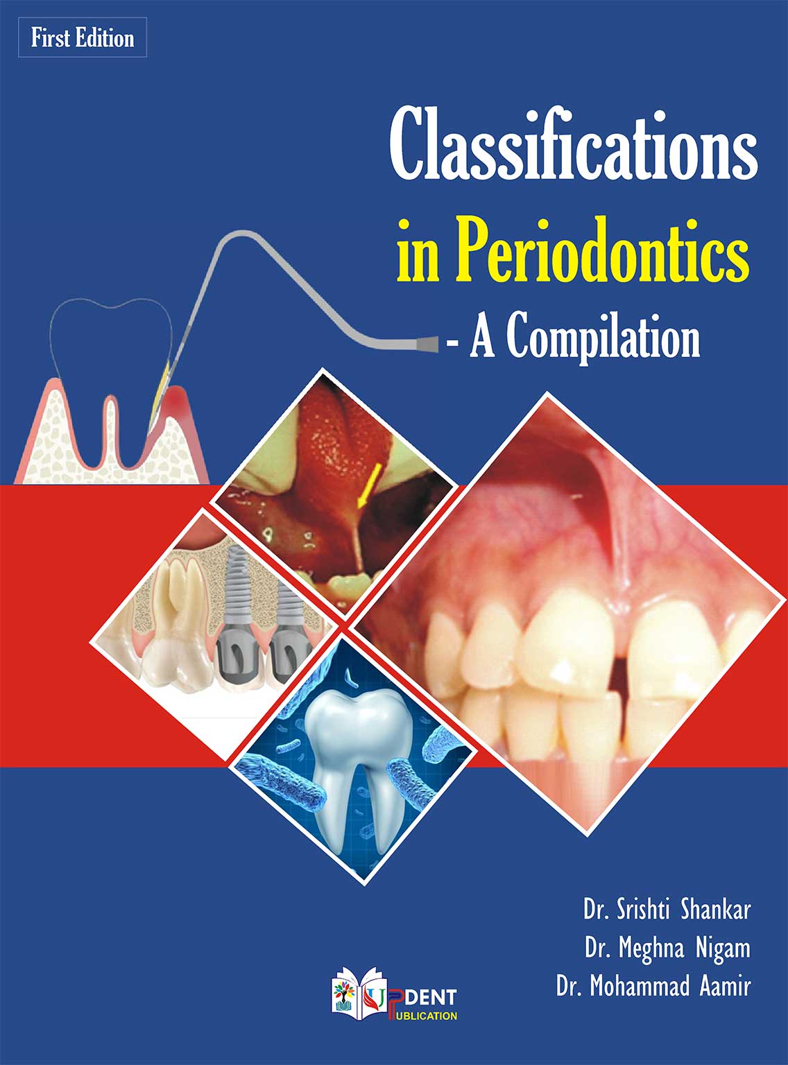 103 کتاب Classifications in Periodontics – A Compilation 2024