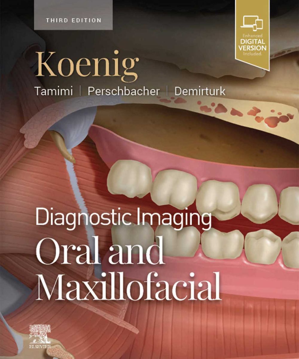 کتاب DIAGNOSTIC IMAGING: ORAL AND MAXILLOFACIAL – Koenig 2024 (THIRD EDITION) 2VOL