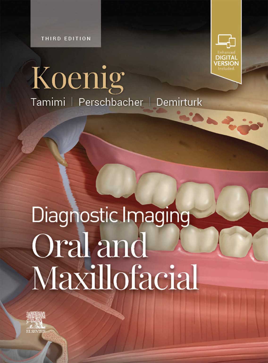 108 کتاب DIAGNOSTIC IMAGING: ORAL AND MAXILLOFACIAL – Koenig 2024 (THIRD EDITION) 2VOL