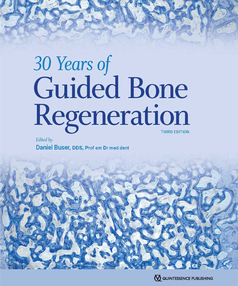 کتاب 30Years of Guided Bone Regeneration 2022
