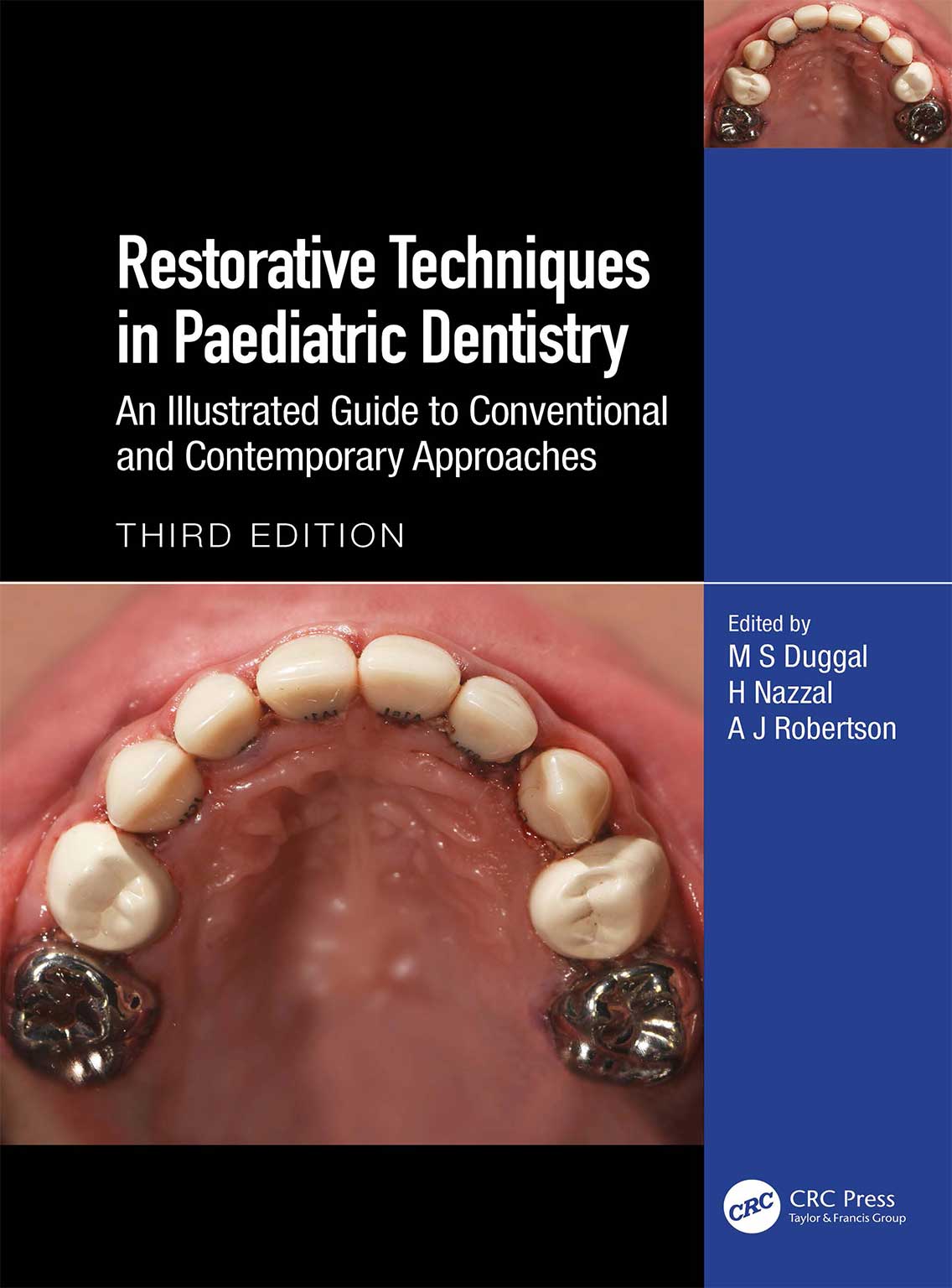 112 کتاب Restorative Techniques in Paediatric Dentistry 2024