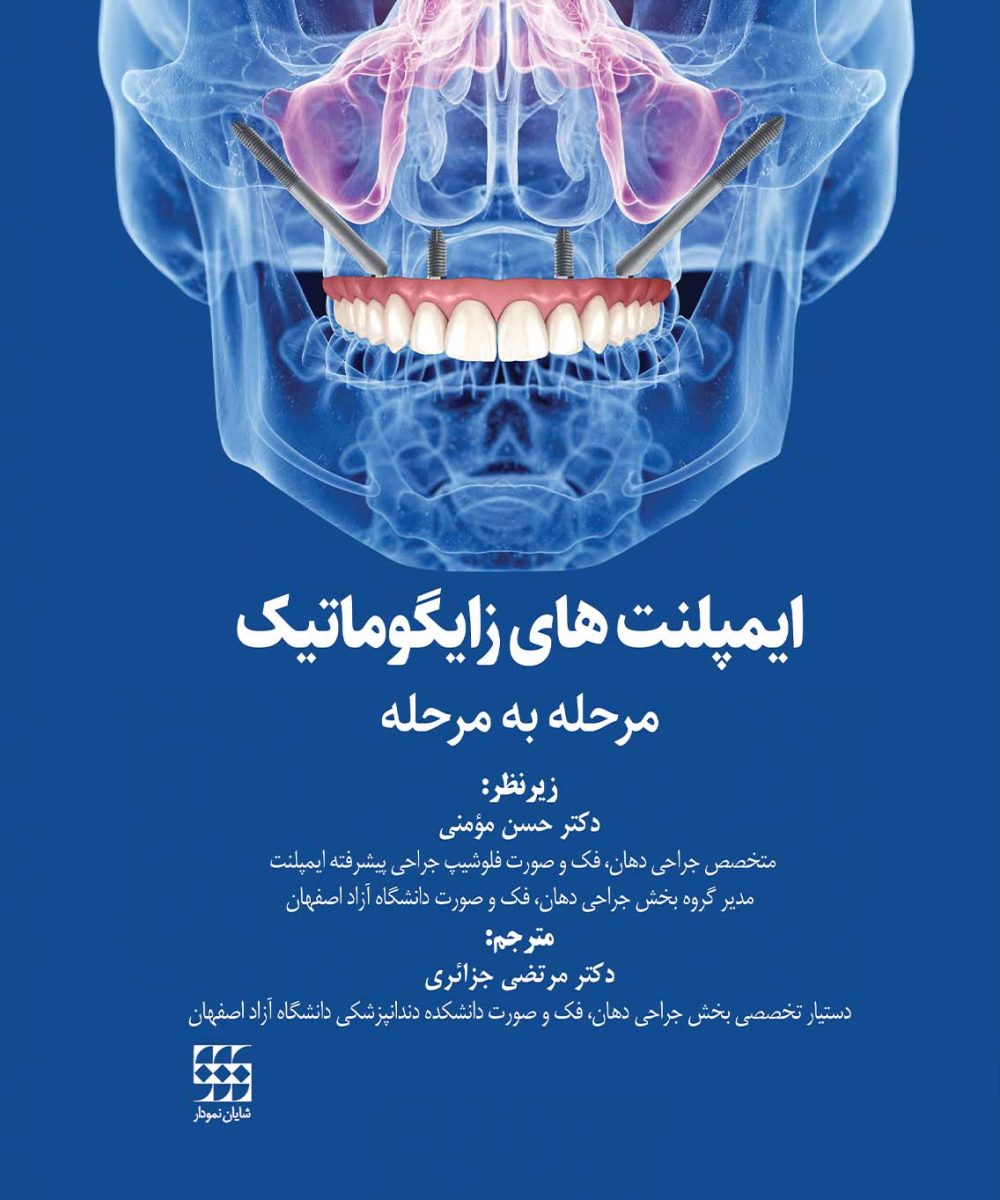 کتاب ایمپلنت های زایگوماتیک (مرحله به مرحله)