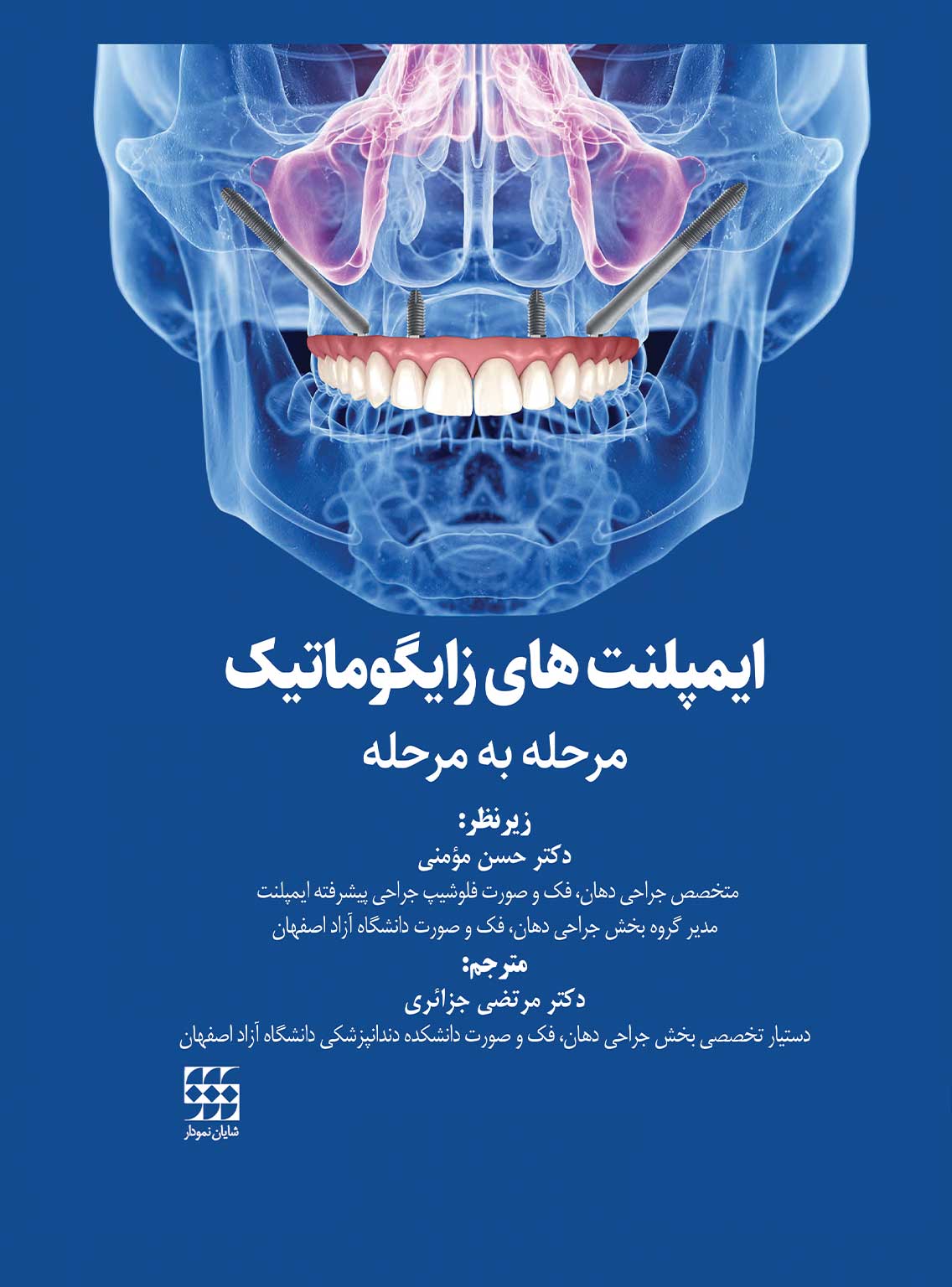 138 کتاب ایمپلنت های زایگوماتیک (مرحله به مرحله)
