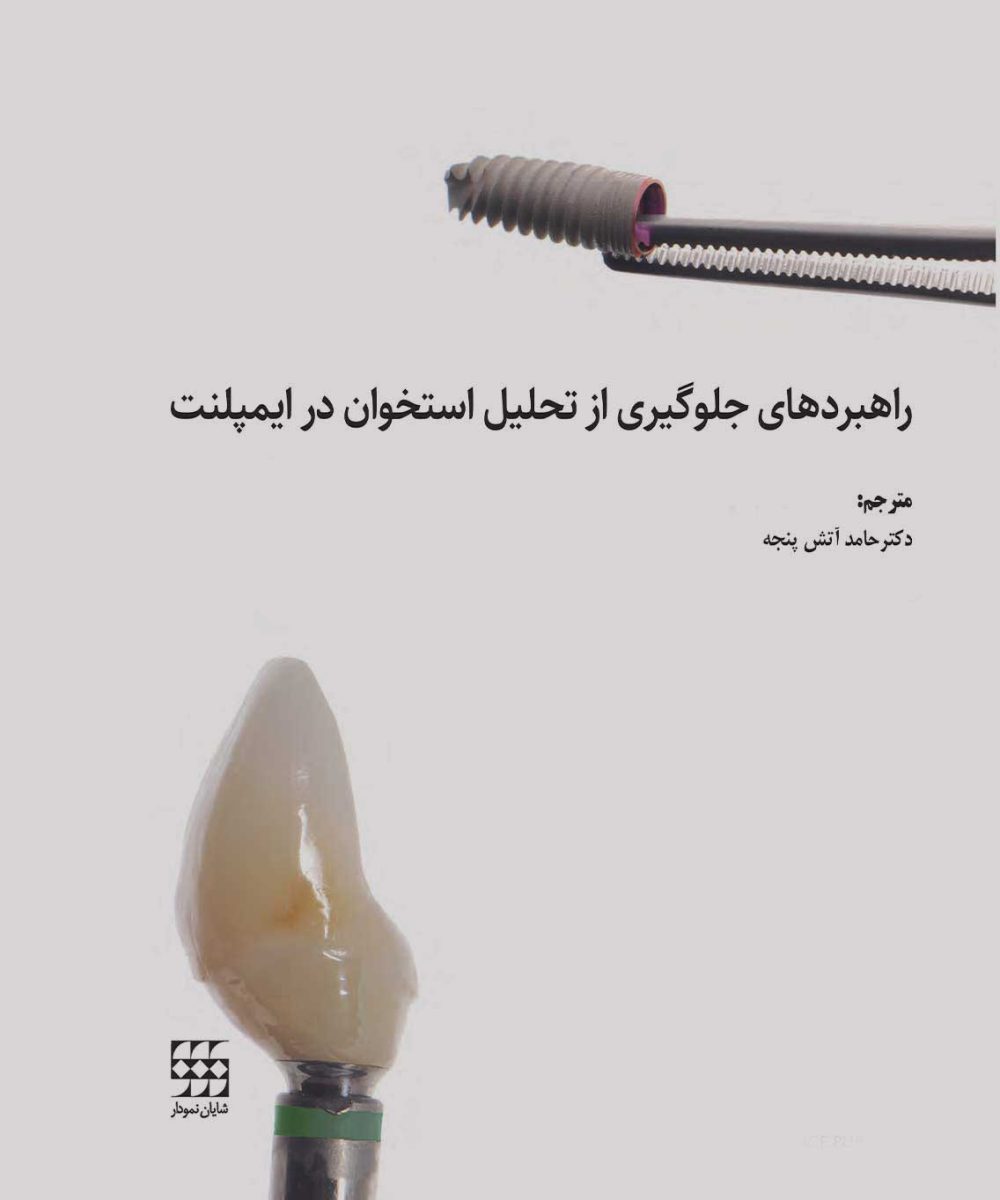 کتاب راهبردهای جلوگیری از تحلیل استخوان در ایمپلنت