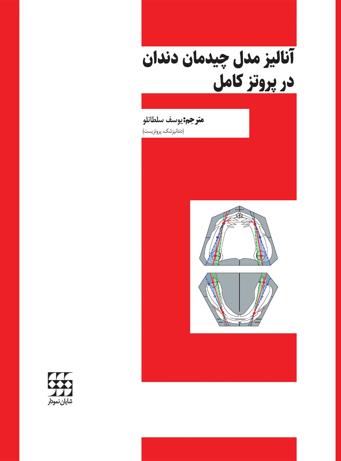 99 کتاب آنالیز مدل چیدمان دندان در پروتز کامل