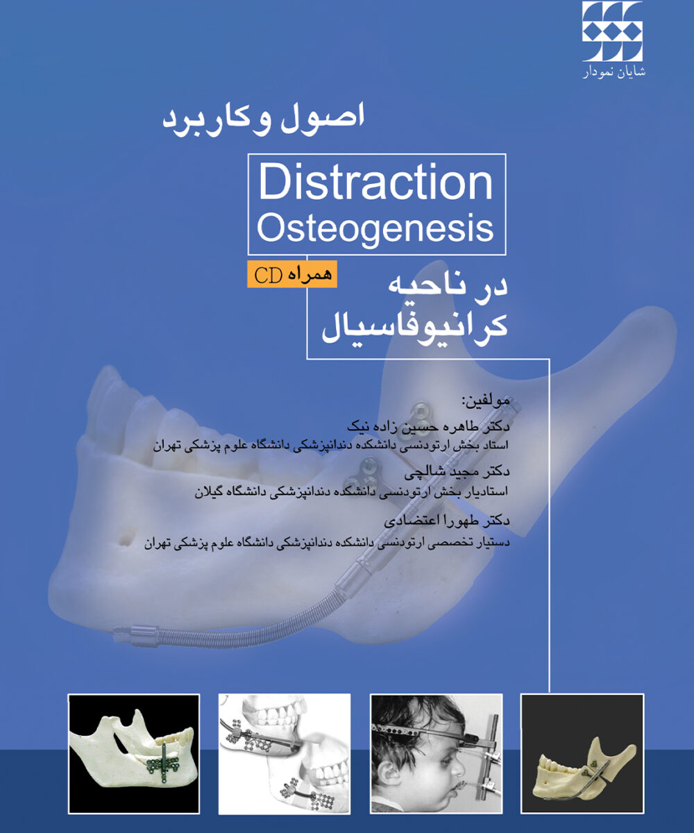 اصول و کاربرد Distraction Osteogenesis در ناحیه کرانیوفاسیال همراه با CD