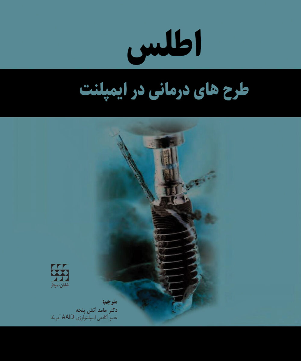 کتاب اطلس طرح های درمانی در ایمپلنت