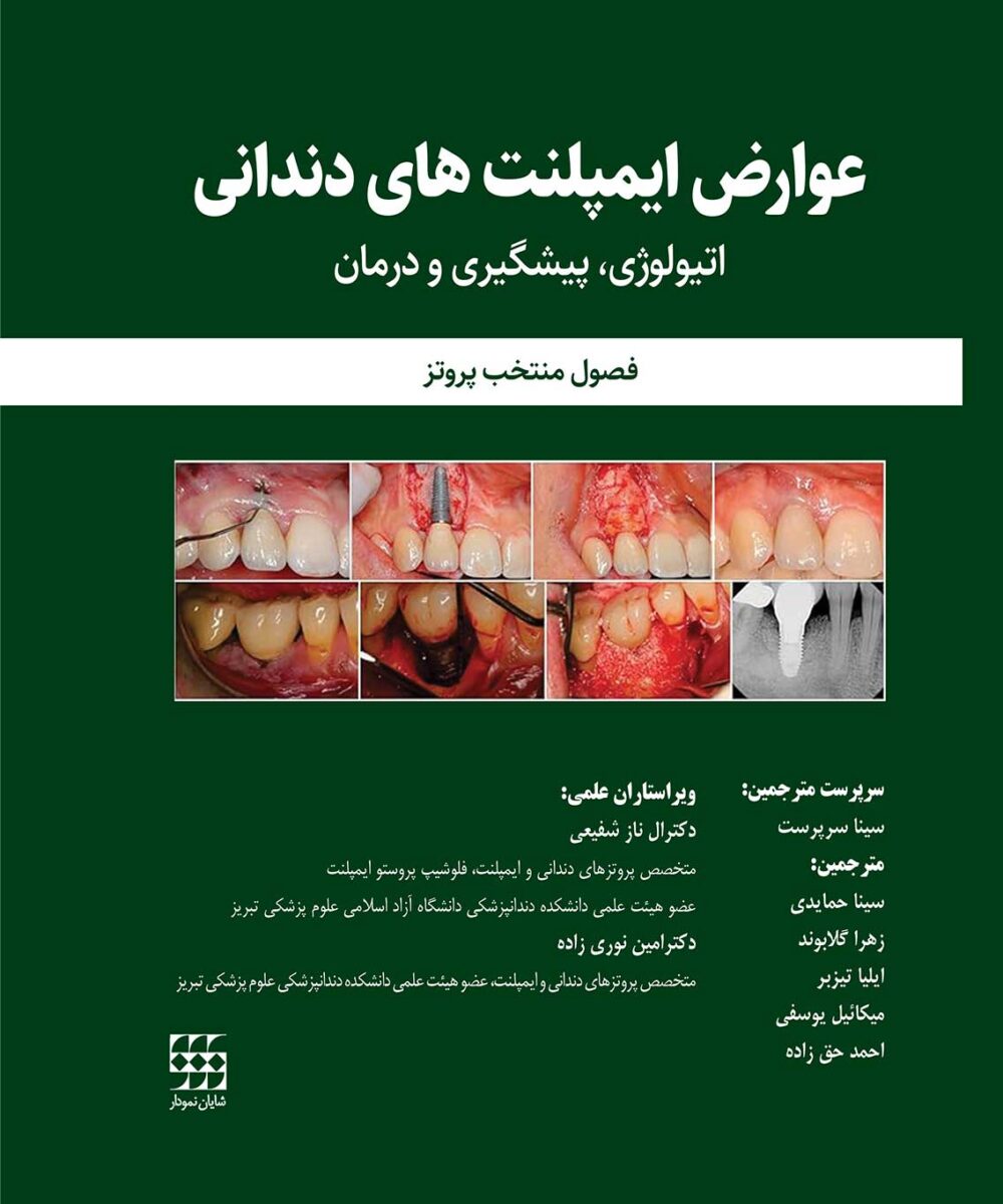 کتاب عوارض درمان ایمپلنت های دندانی: اتیولوژی، پیشگیری و درمان (فصول منتخب پروتز)