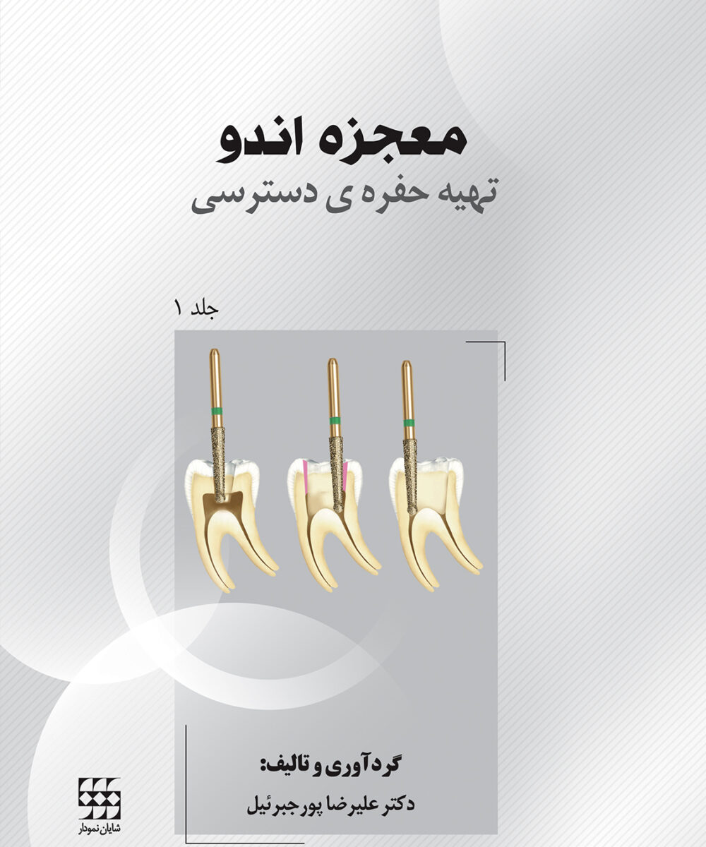 کتاب معجزه اندو (تهیه حفره ی دسترسی) – جلد 1