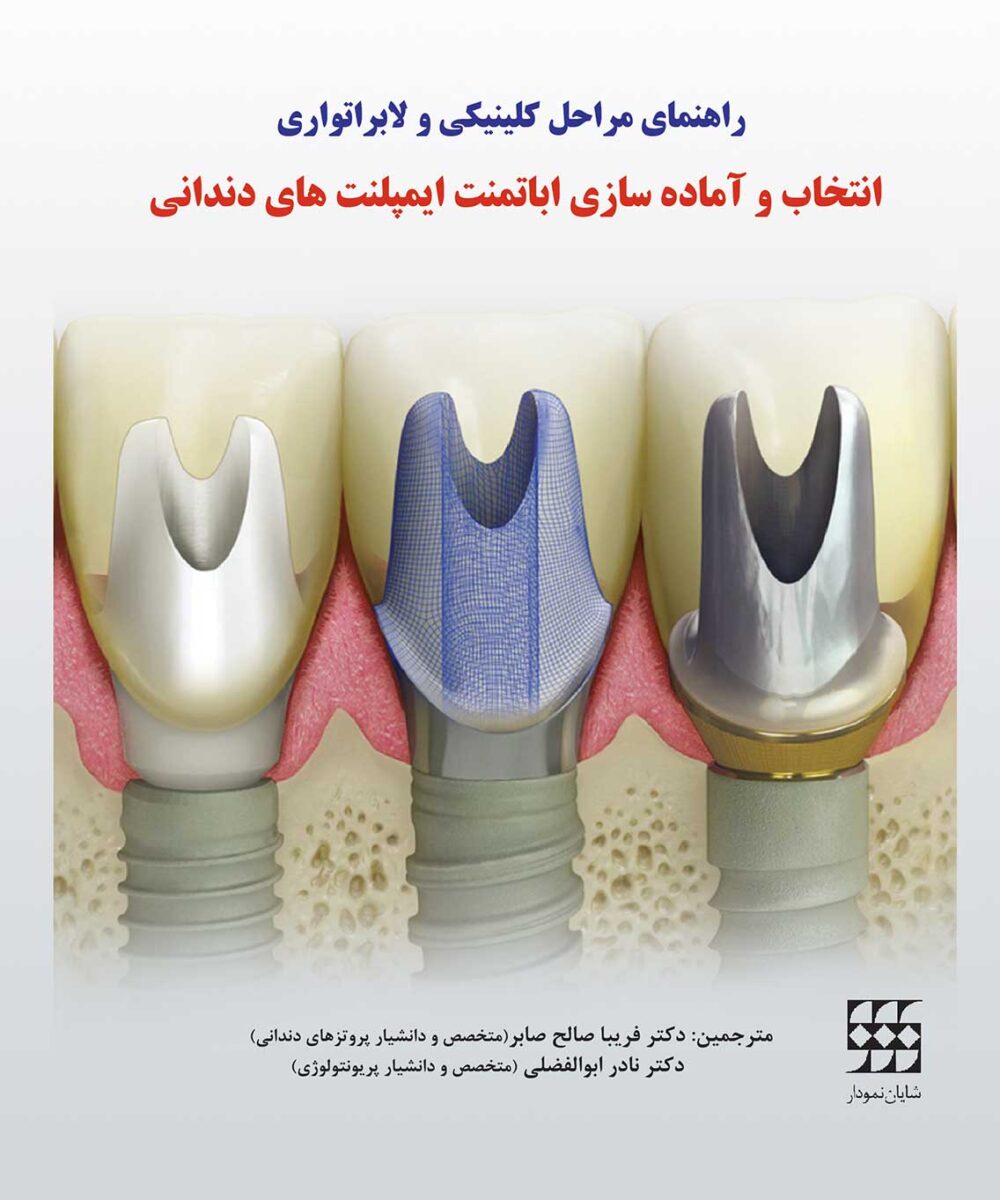 کتاب راهنمای مراحل کلینیکی و لابراتواری انتخاب و آماده‌سازی اباتمنت ایمپلنت‌های دندانی شومیز