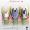 کتاب پیوند استخوانی سینوس ۲۰۱۹ (ویرایش سوم)