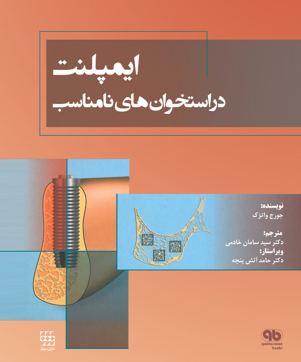 کتاب ایمپلنت در استخوان های نامناسب شومیز