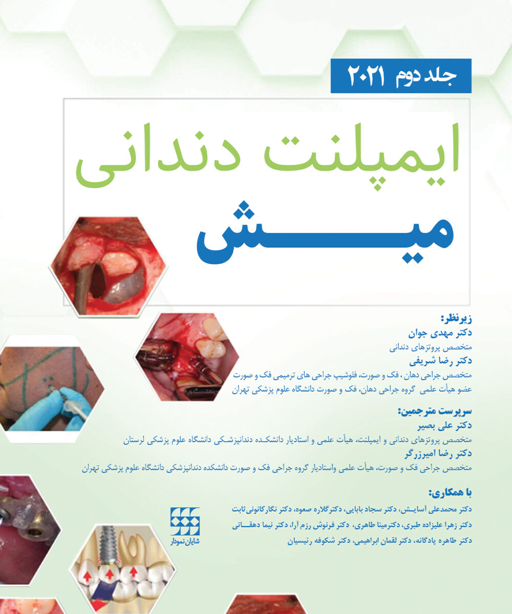 کتاب ایمپلنت دندانی میش 2021 جلد دوم تحریر رنگی