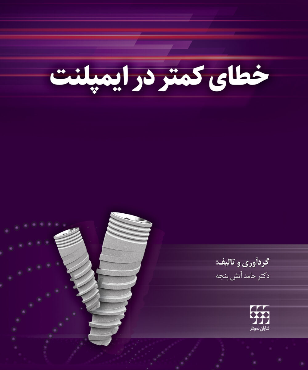 کتاب خطای کمتر در ایمپلنت