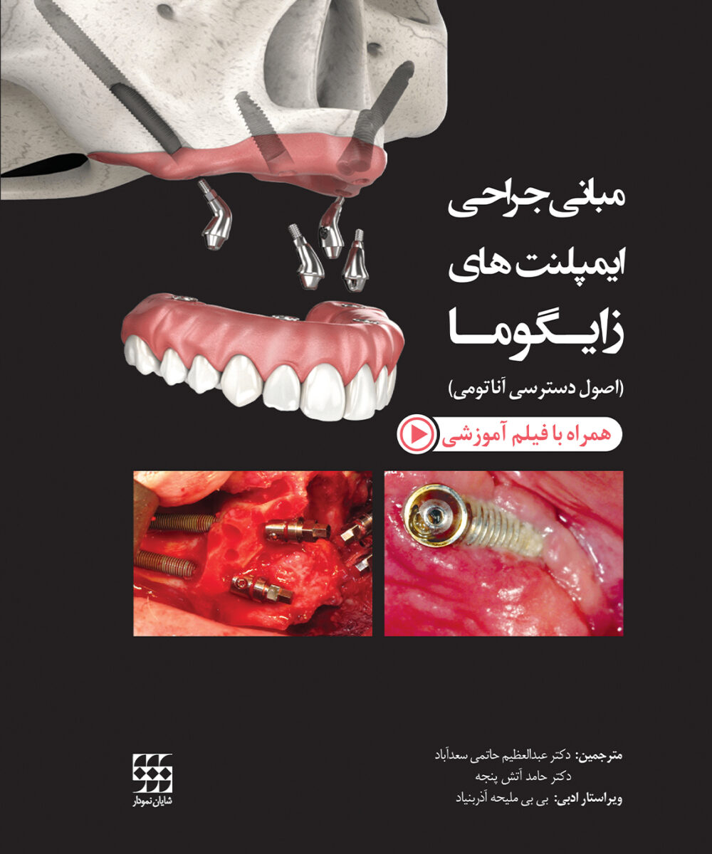 کتاب مبانی جراحی ایمپلنت های زایگوما (اصول دسترسی آناتومی) شومیز