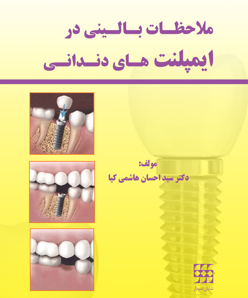 کتاب ملاحظات بالینی در ایمپلنت های دندانی